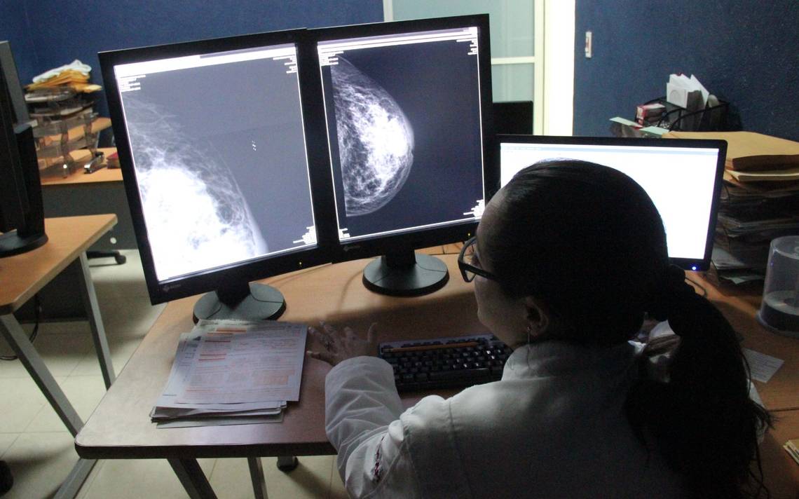 Hidalgo Health offers comprehensive care to prevent breast cancer – El Sol de Tulancingo